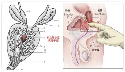 男性の前立腺部尿道の男子小子宮画像
